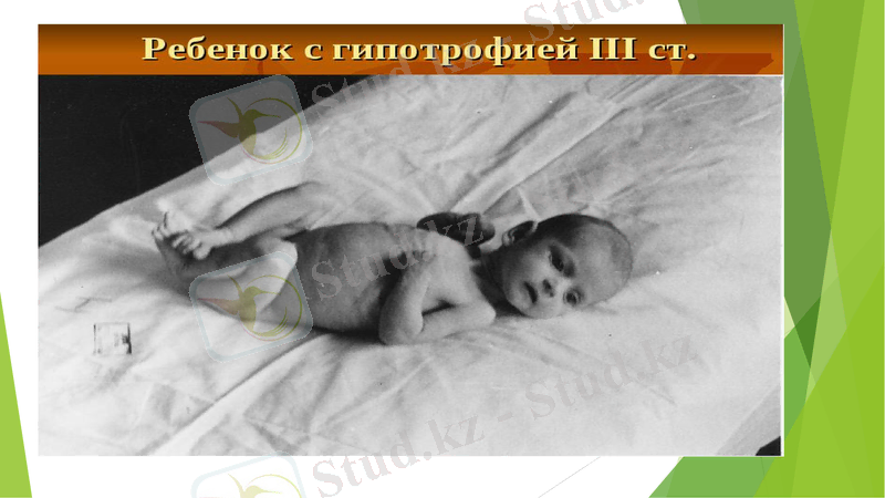 Slide 17