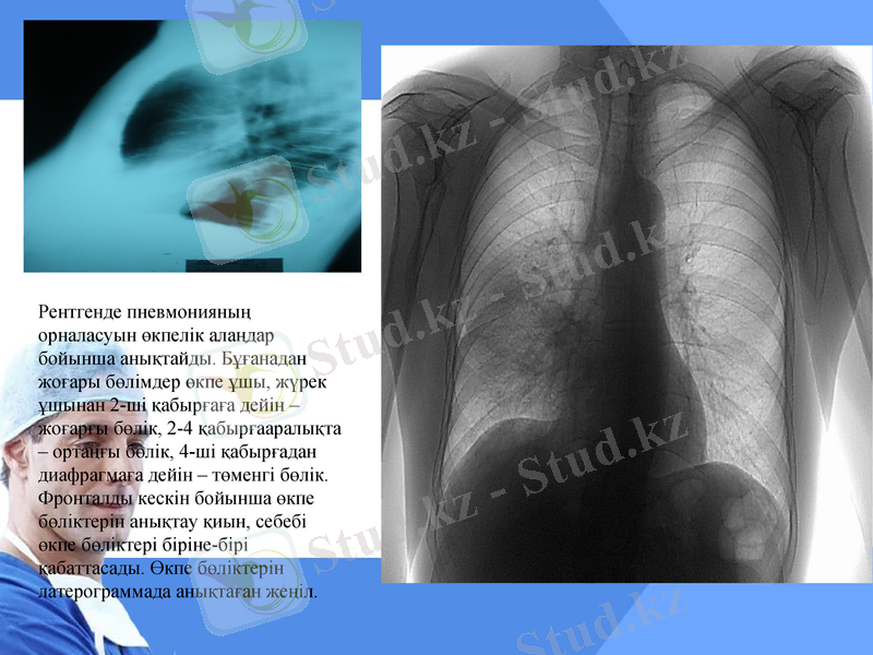 Slide 14