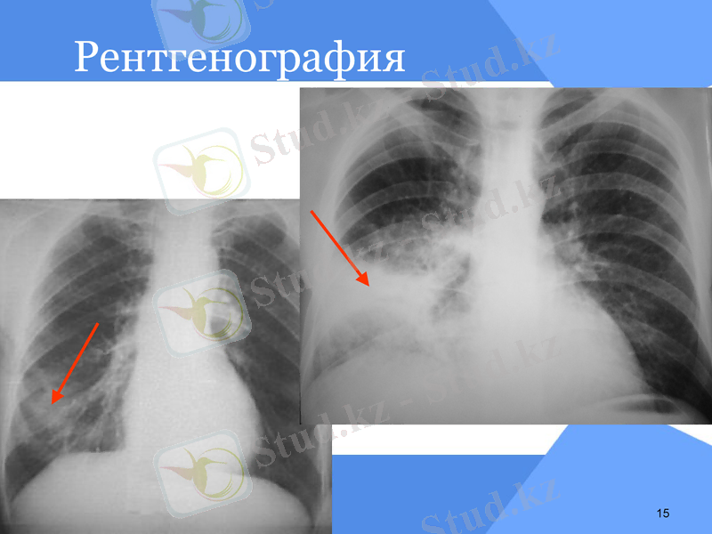 Slide 15