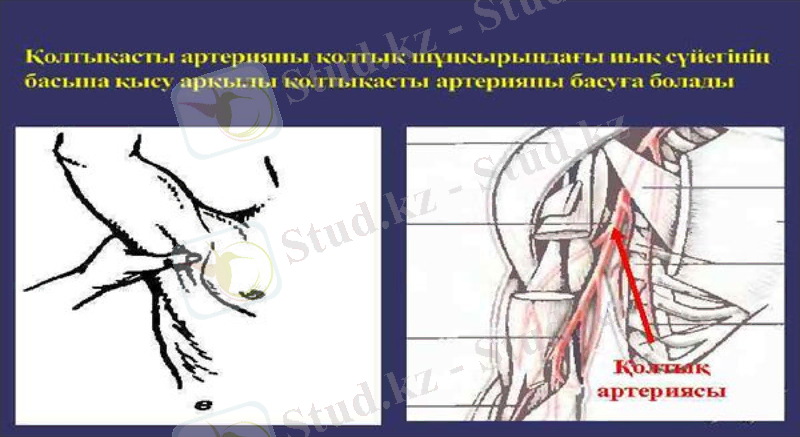 Slide 15