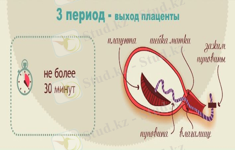 Slide 29