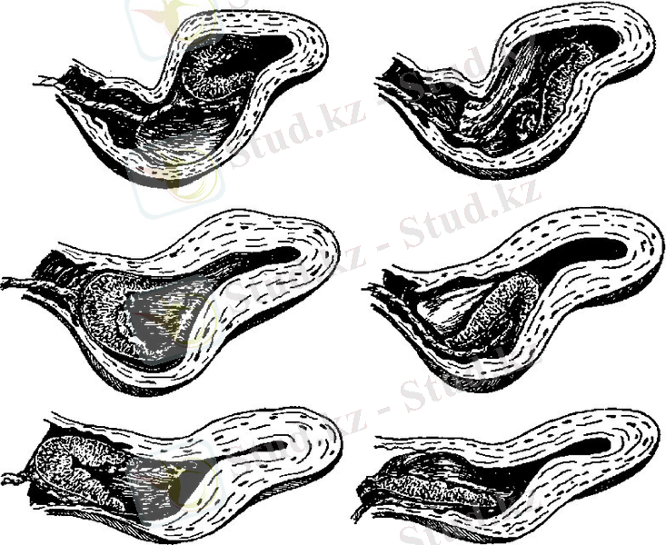 Slide 30