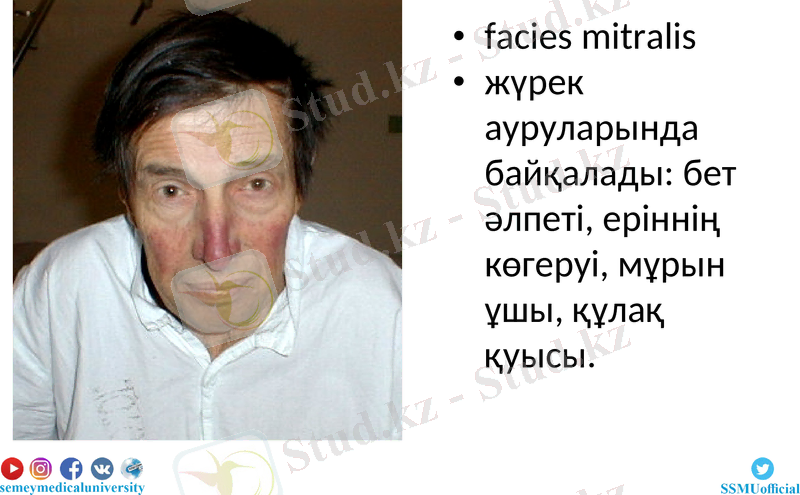 Slide 17