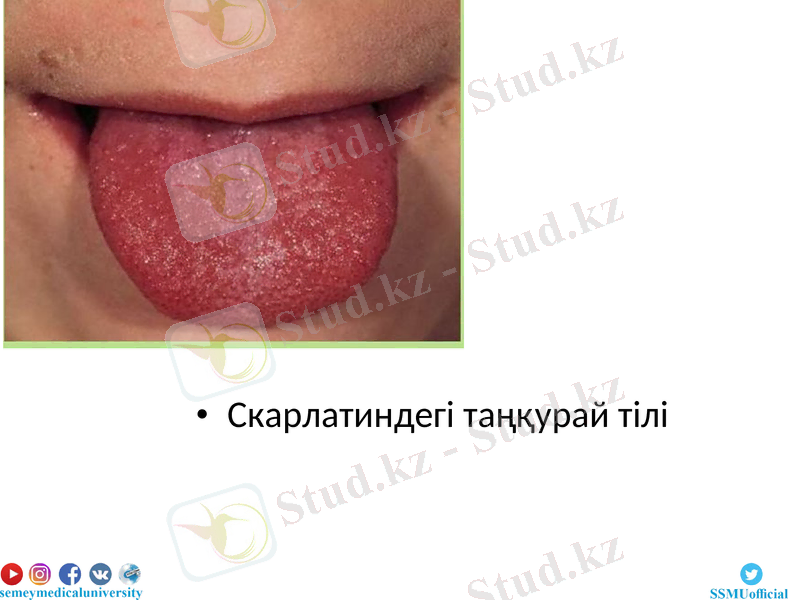 Slide 20