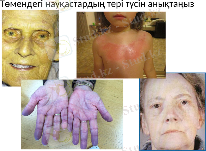 Slide 23