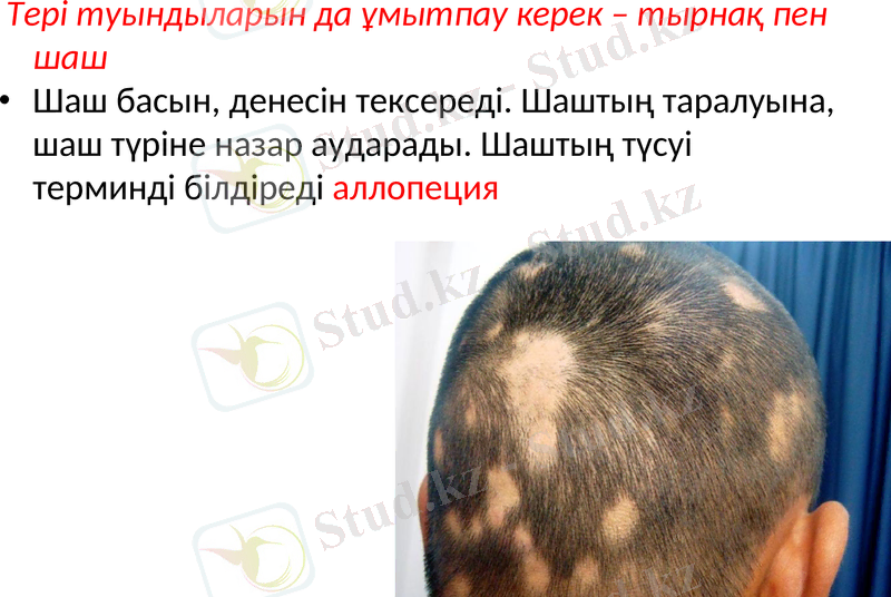 Slide 31