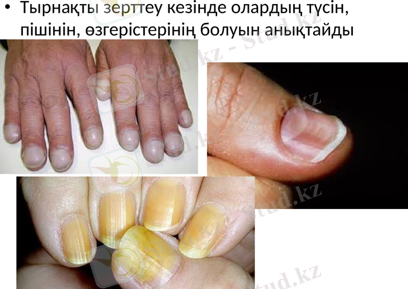 Slide 32