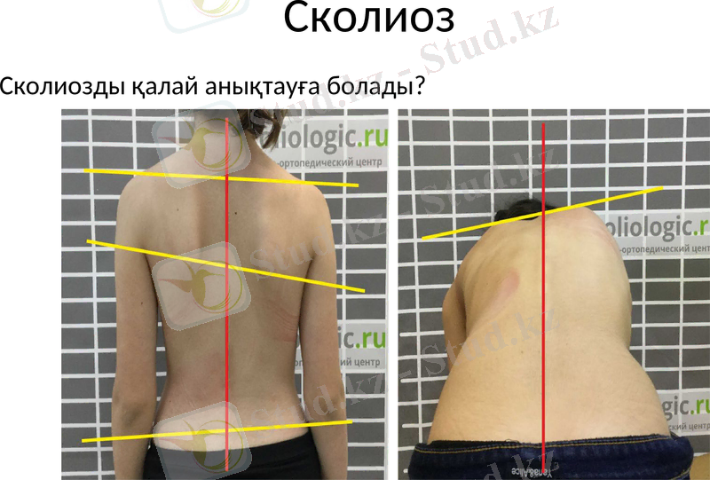 Slide 36