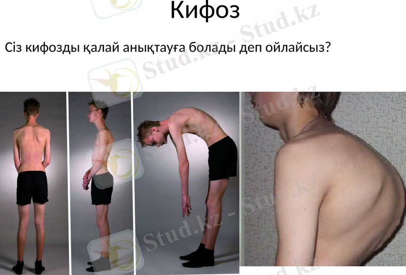 Slide 37
