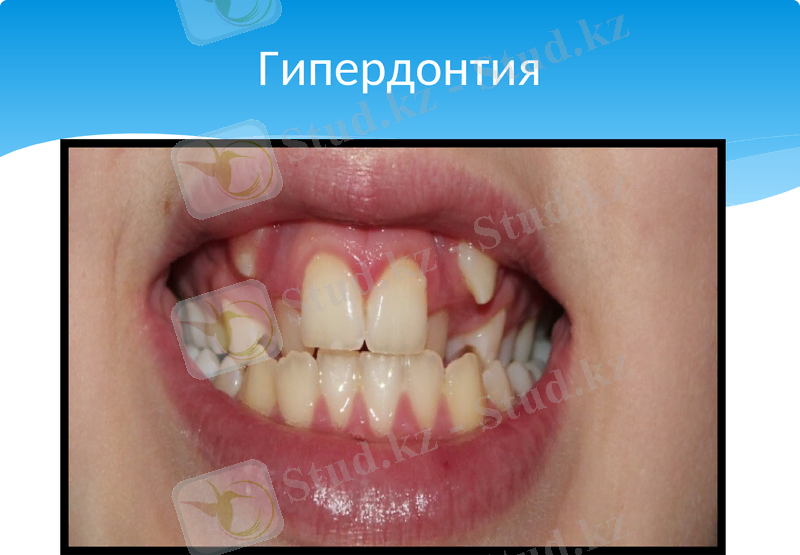 Slide 11