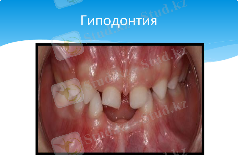 Slide 12