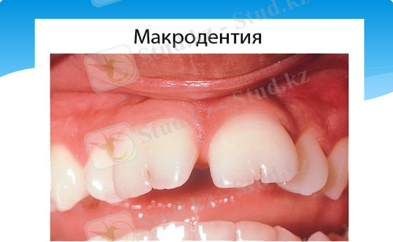 Slide 8