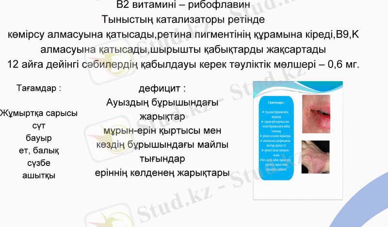 Slide 15