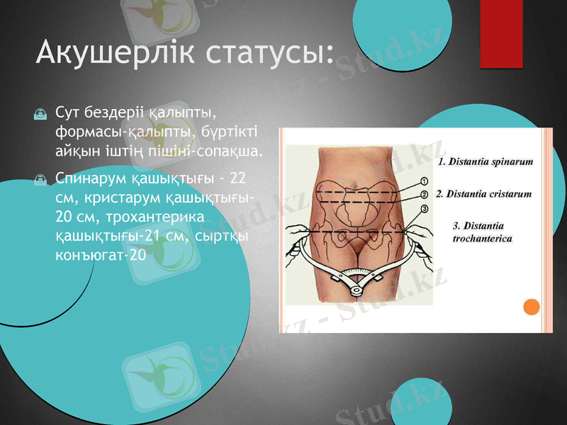 Slide 12