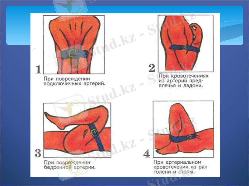 Slide 16
