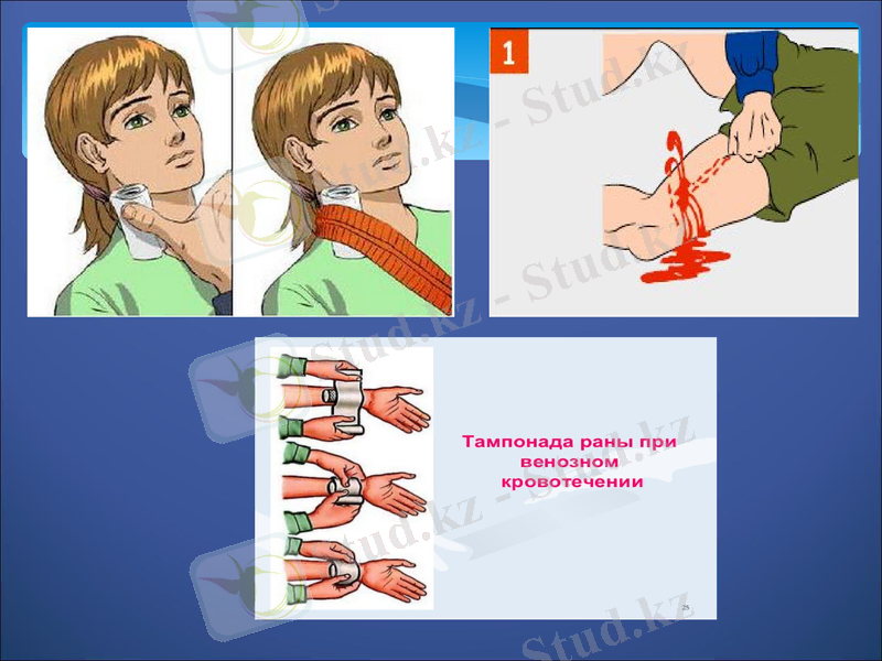 Slide 18