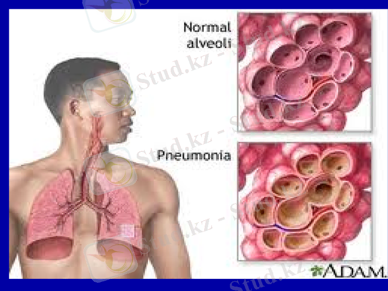Slide 16