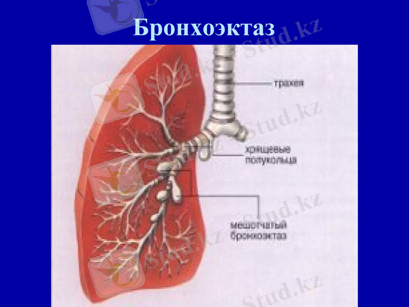 Slide 28