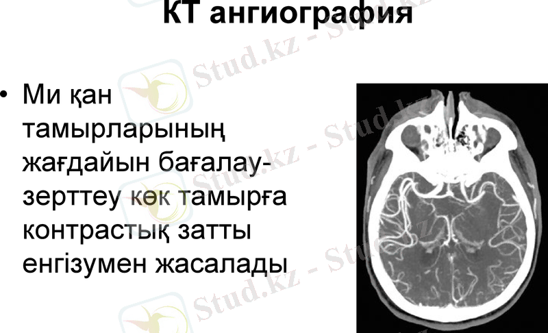 Slide 11