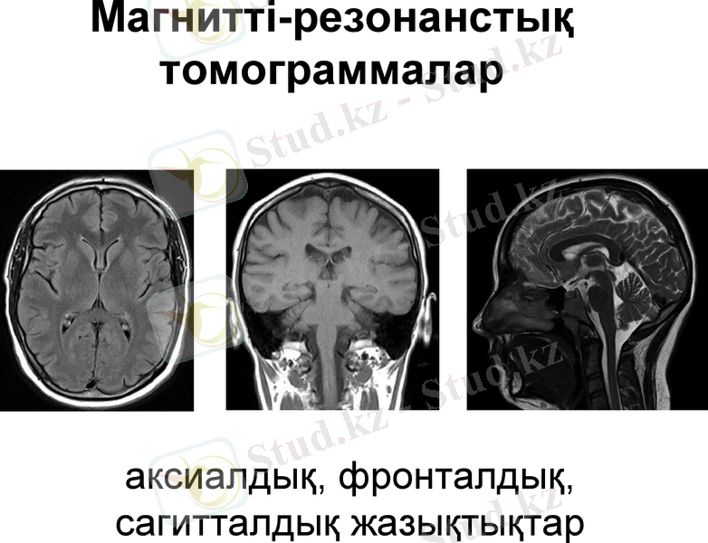 Slide 13