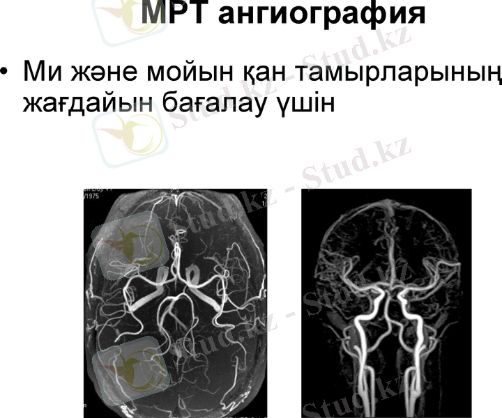 Slide 14