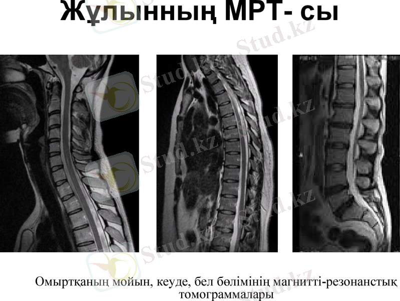 Slide 15