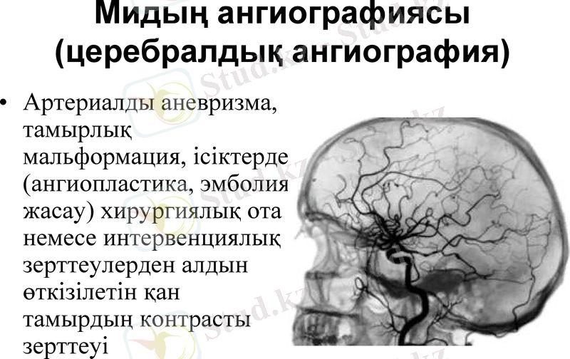 Slide 16