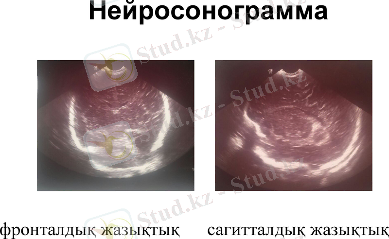 Slide 18