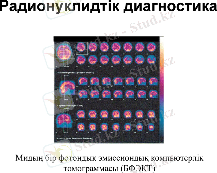 Slide 22
