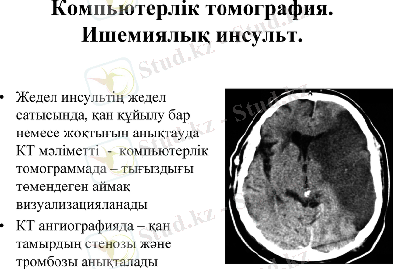 Slide 26