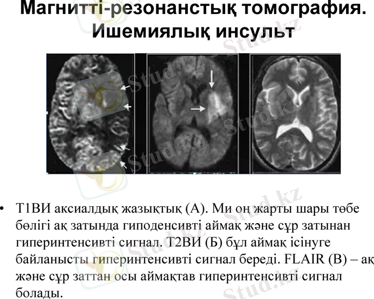 Slide 28