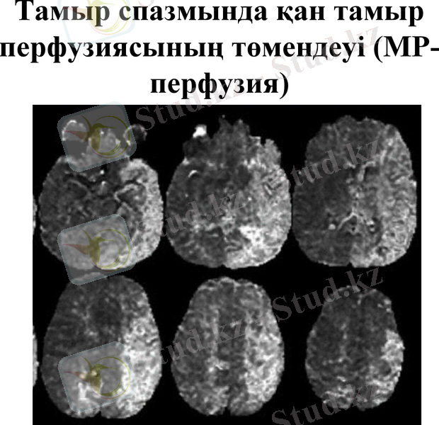 Slide 29