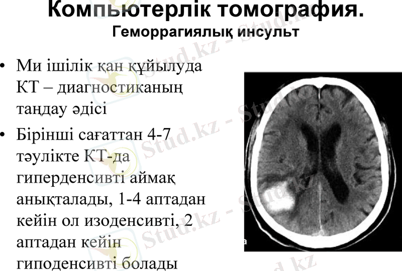 Slide 32