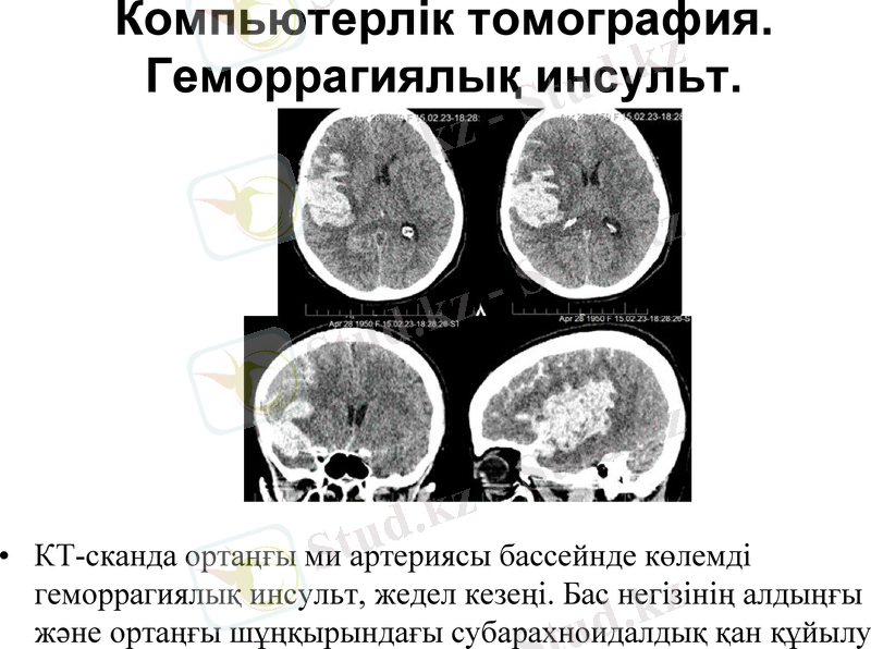 Slide 33