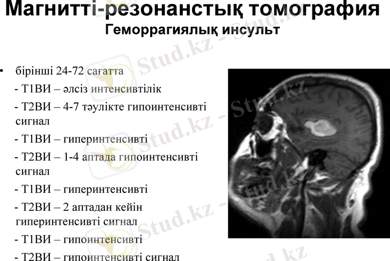 Slide 34