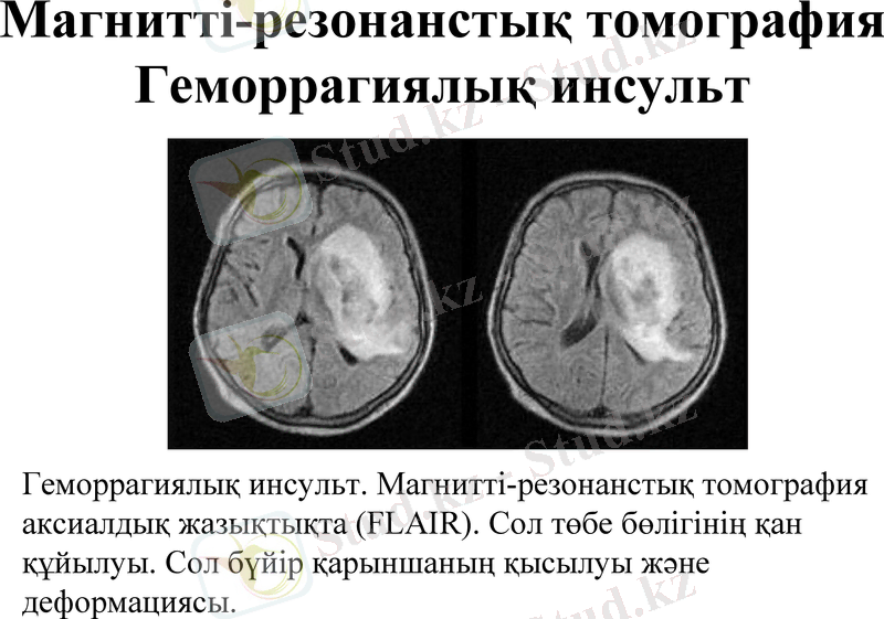 Slide 35