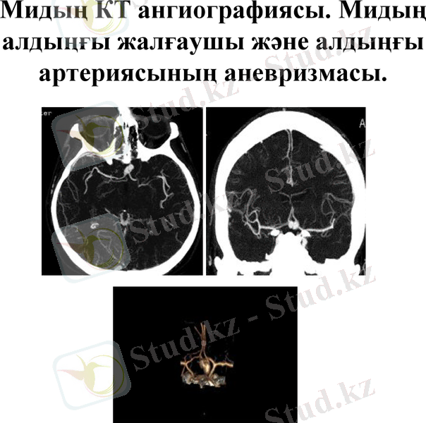 Slide 36