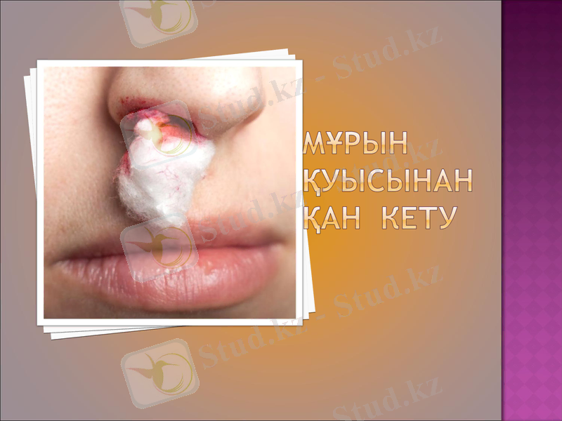 Slide 11