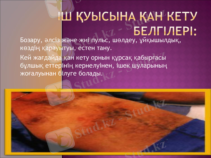 Slide 14