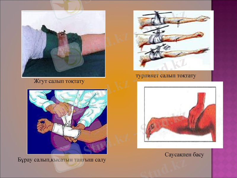 Slide 17