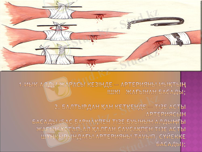 Slide 18