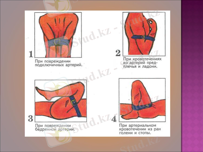 Slide 20