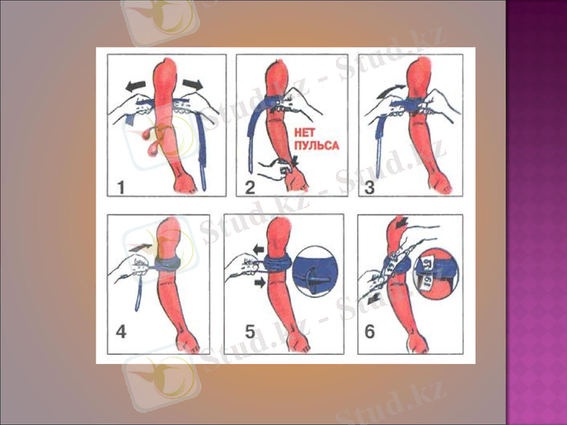 Slide 21
