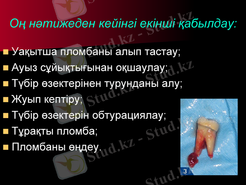 Slide 14
