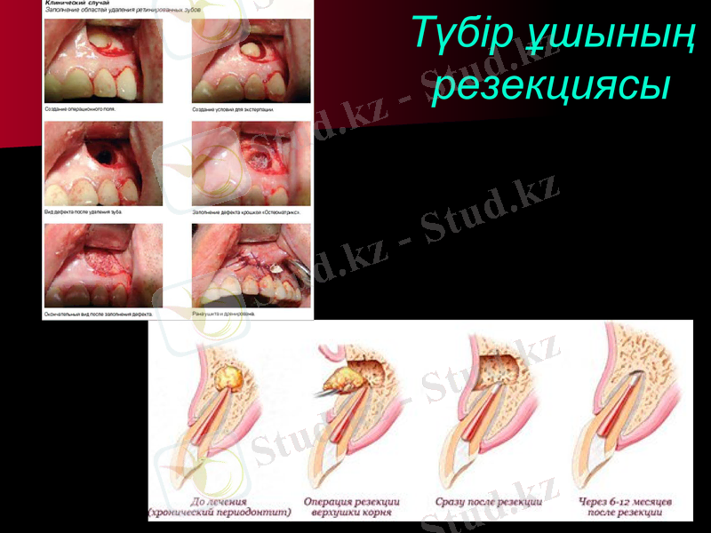 Slide 20