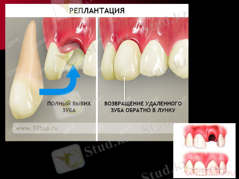 Slide 21