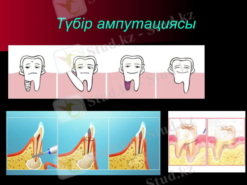 Slide 22