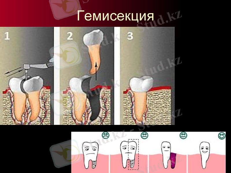 Slide 23