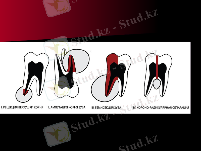 Slide 24